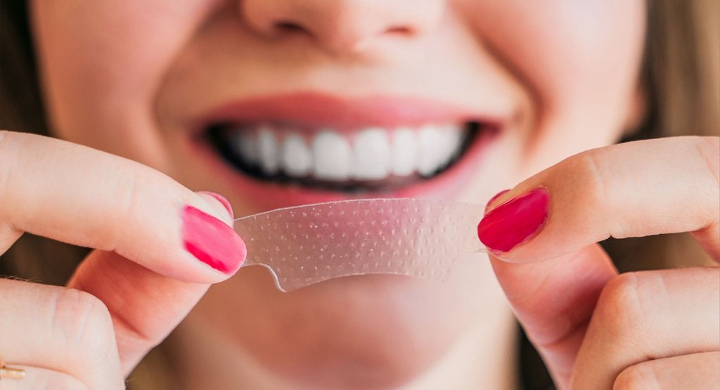 3D trake za izbjeljivanje zubi (14 komada)