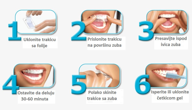 3D trake za izbjeljivanje zubi (14 komada)