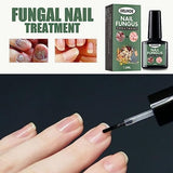 Proizvod PRODAVANI namenjen rutini nege noktiju.
