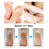 Bežična rotirajuća turpija za glatke pete i stopala