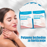 Prikaz flastera PRODAVANI za negu kože kod bradavica.