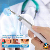 Апарат за уклањање зубног камена