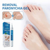 Nega noktiju na nogama - gel za popravku oštec?enja noktiju